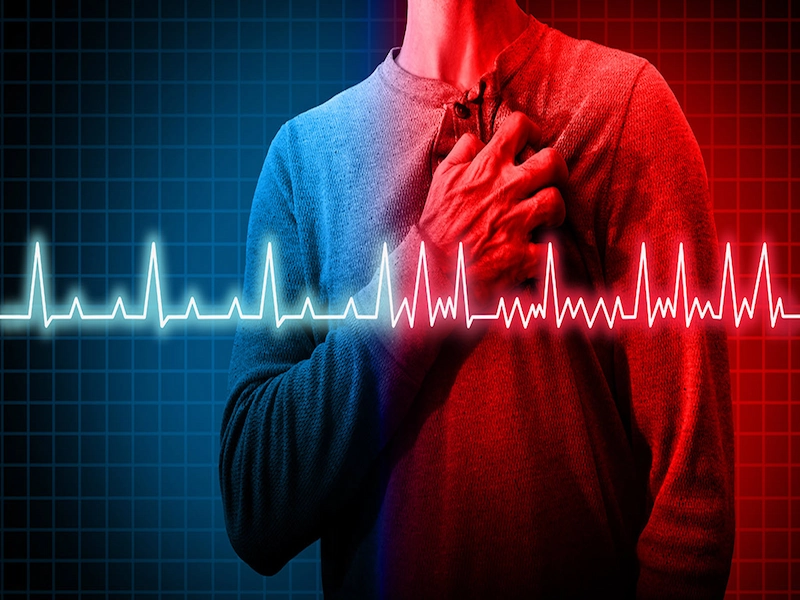عوامل موثر ابتلا به آریتمی قلبی